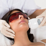 laser treatment