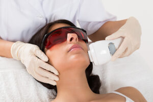 laser treatment
