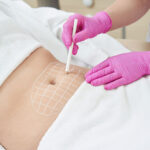 The Benefits of Weight Loss Injections & Body Contouring
