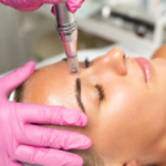 The Do's and Don'ts of Microneedling Aftercare